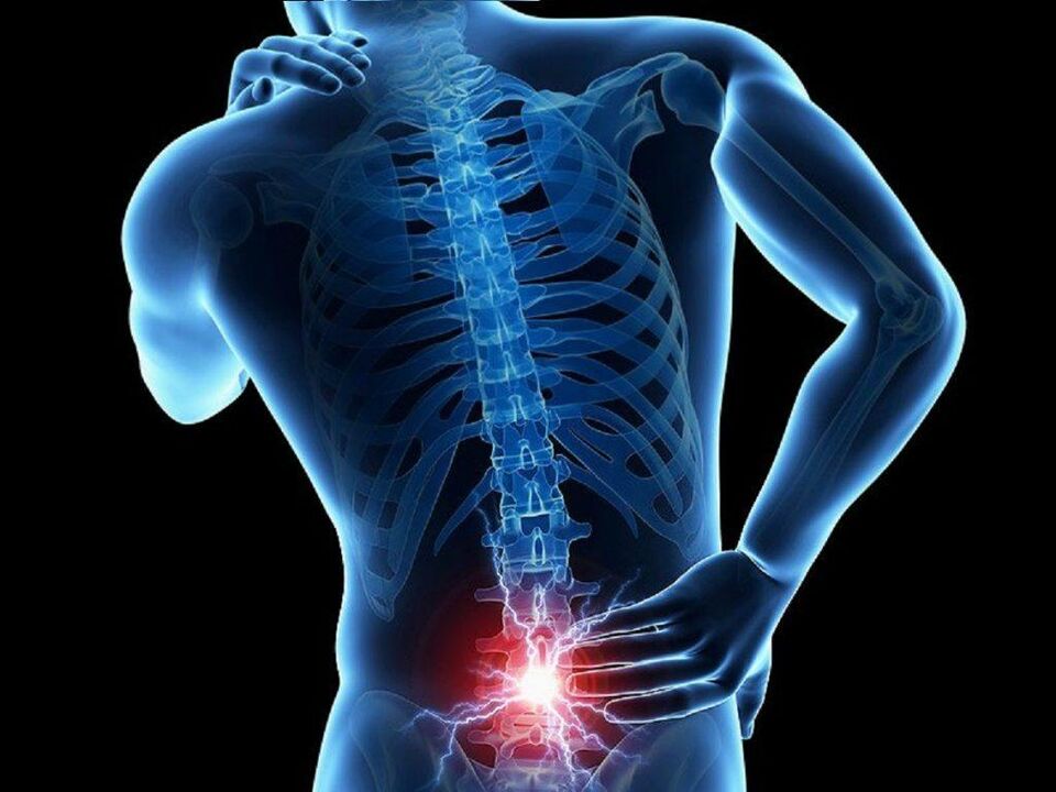остеохондроза на лумбалния отдел на гръбначния стълб