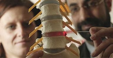 изследване на остеохондроза по модел на гръбначния стълб
