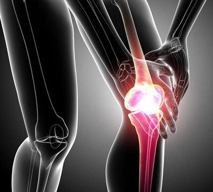 увреждане на колянната става с артрит и артроза